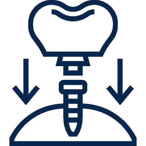 best dental implant clinic in Nibm road pune